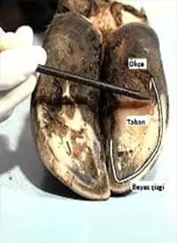 Beyaz Çizgi Hastalığı