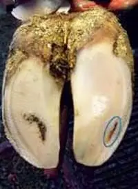 Beyaz Çizgi Hastalığı