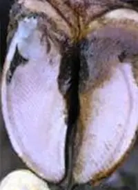 Beyaz Çizgi Hastalığı