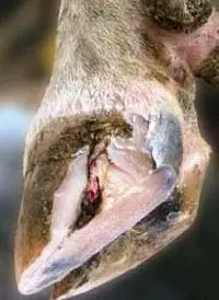 Beyaz Çizgi Hastalığı