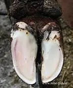 Beyaz Çizgi Hastalığı