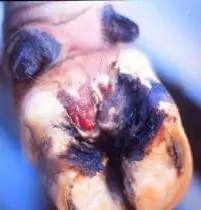Erosio Ungulea