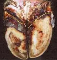 Erosio Ungulea