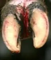 Interdigital Dermatitis