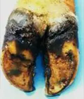 Interdigital Dermatitis