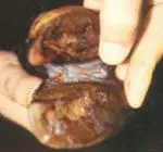 Interdigital Dermatitis