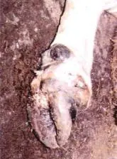 Panarisyum