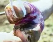 Panarisyum
