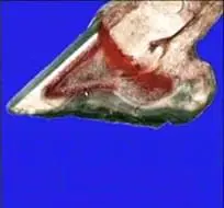 Pododermatitis Aseptica