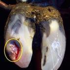 Pododermatitis Aseptika Circumcripta