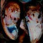 Pododermatitis Aseptika Circumcripta