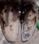 Pododermatitis Aseptika Circumcripta