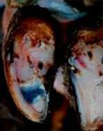 Pododermatitis Aseptika Circumcripta