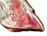 Pododermatitis Aseptika Circumcripta