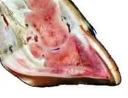 Pododermatitis Aseptika Circumcripta