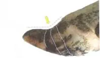 Pododermatitis Aseptika Diffuza