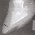 Pododermatitis Aseptika Diffuza