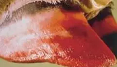 Pododermatitis Aseptika Diffuza