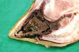 Pododermatitis Necroticans et Gangrenosa