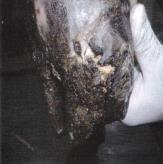 Pododermatitis Necroticans et Gangrenosa