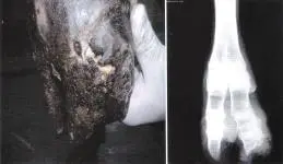 Pododermatitis Necroticans et Gangrenosa