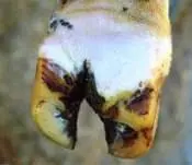 Pododermatitis Purulenta Superficialis