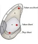 Taban Ucu Apsesi