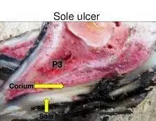 Taban Ülseri