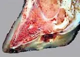 Taban Ülseri