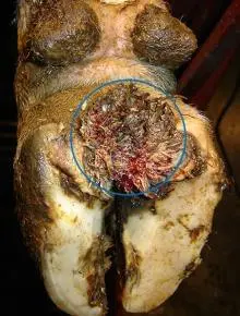 Verrikoz Dermatitis