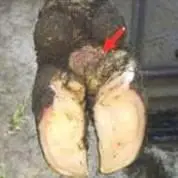 Verrikoz Dermatitis
